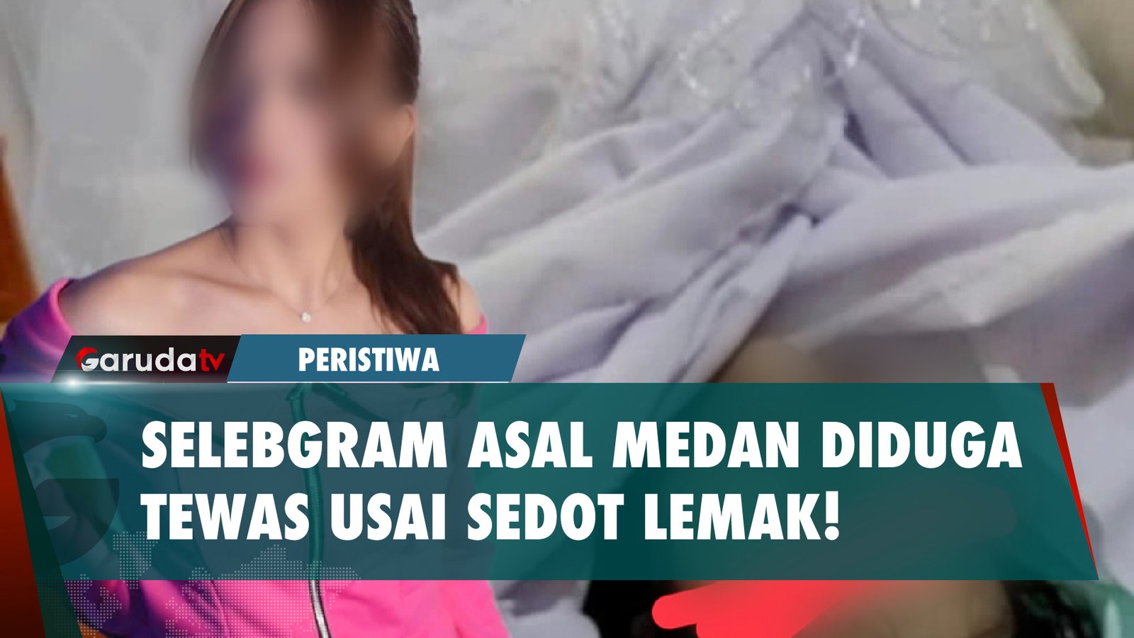 Selebgram Asal Medan Meninggal Dunia Diduga Setelah Sedot Lemak di Depok