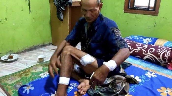 Kakek Berusia 60 Tahun Dibacok Dua Begal di Kabupaten Bekasi