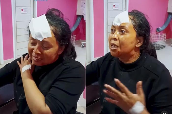 Kecelakaan Tol Ciawi, Istri Yana Mulyana: Kejadian Begitu Cepat