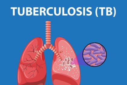 Kampanye RW Bebas TBC di Tangsel gencar dilakukan selama musim hujan, setelah tercatat 2.639 kasus sejak awal tahun.