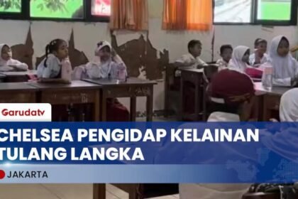 Presiden Prabowo Bantu Chelsea, Anak 9 Tahun Pengidap Kelainan Tulang Bisa Sekolah di SD Negeri