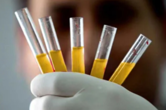 Hanya 50 Orang di Dunia Miliki "Golden Blood", Golongan Darah Paling Langka