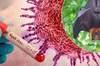 Waspada Nipah: Virus Tanpa Obat yang Bisa Bunuh 3 dari 4 Orang, Begini Cara Melindungi Diri