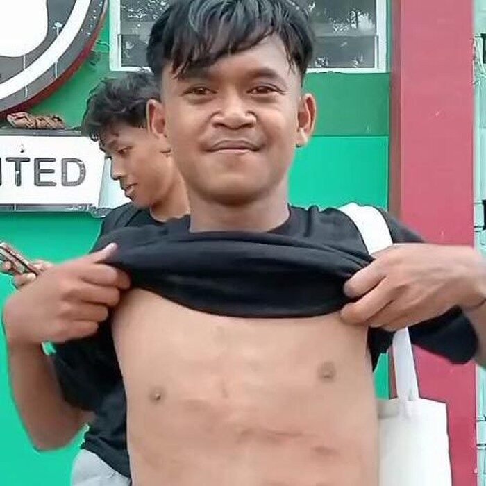 Begini Kondisi Pemain Perseta Tulungagung Setelah Dapat Tendangan Kungfu di Dada 2 Begini Kondisi Pemain Perseta Tulungagung Setelah Dapat Tendangan Kungfu di Dada
