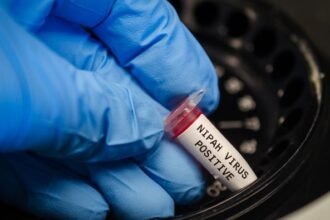 India Darurat Virus Nipah : 100 Orang Dikarantina, Bandara Nepal Hingga Hongkong Panik