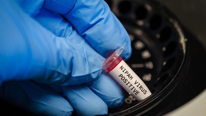 India Darurat Virus Nipah : 100 Orang Dikarantina, Bandara Nepal Hingga Hongkong Panik