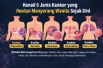 Kenali 5 Jenis Kanker yang Rentan Menyerang Wanita Sejak Dini