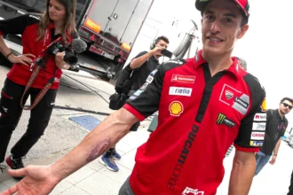 Penampakan Luka di Lengan Marc Marquez, Setelah Jatuh Dari Motor yang Sedang Gaspol 190 km/Jam