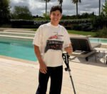 Marc Marquez Sukses Jalani Operasi Ganda Usai Kecelakaan Horor di Le Mans