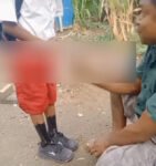 Kisah Nyata Marciano, Bocah SD di NTT yang Viral Usai Kakinya Diolesi Arang Pengganti Kaos Kaki