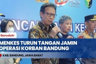 Menkes Budi Gunadi Jamin Operasi Rekonstruksi Wajah Korban Penyekapan Sadis Bandung