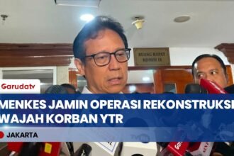 Kemenkes Tanggung Jawab! Menkes Budi Gunadi Jamin Operasi Rekonstruksi Wajah Korban Penyekapan YTR