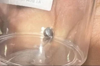 Bocah Perempuan di Bekasi Terluka Diduga Akibat Peluru Nyasar
