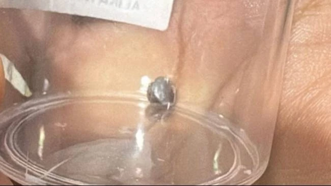 Bocah Perempuan di Bekasi Terluka Diduga Akibat Peluru Nyasar