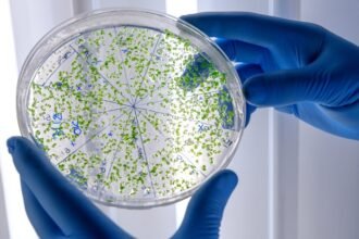 Wabah Legionnaires di New York mencatat korban jiwa pertama saat penyelidikan sumber bakteri Legionella di Upper East Side terus berlangsung.