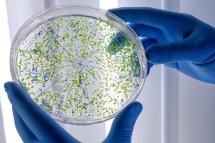 Wabah Legionnaires di New York mencatat korban jiwa pertama saat penyelidikan sumber bakteri Legionella di Upper East Side terus berlangsung.