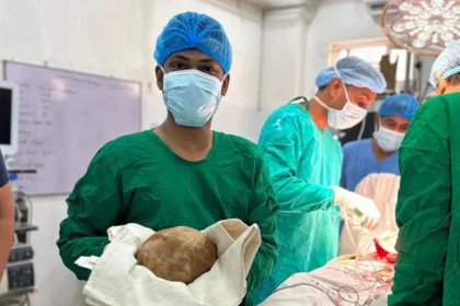 Niat Berobat Stroke, Pria ini Kaget Dokter Temukan Batu 3,1 kg yang Mengendap 10 Tahun di Perutnya