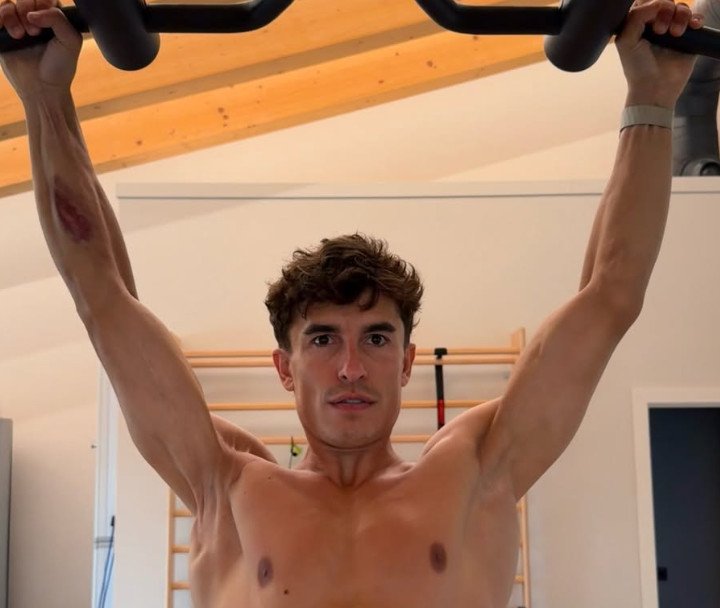 Akibat Kecelakaan Horor di Mandalika, Kekuatan Bisep Kanan Marc Marquez Hanya Tinggal 50 Persen